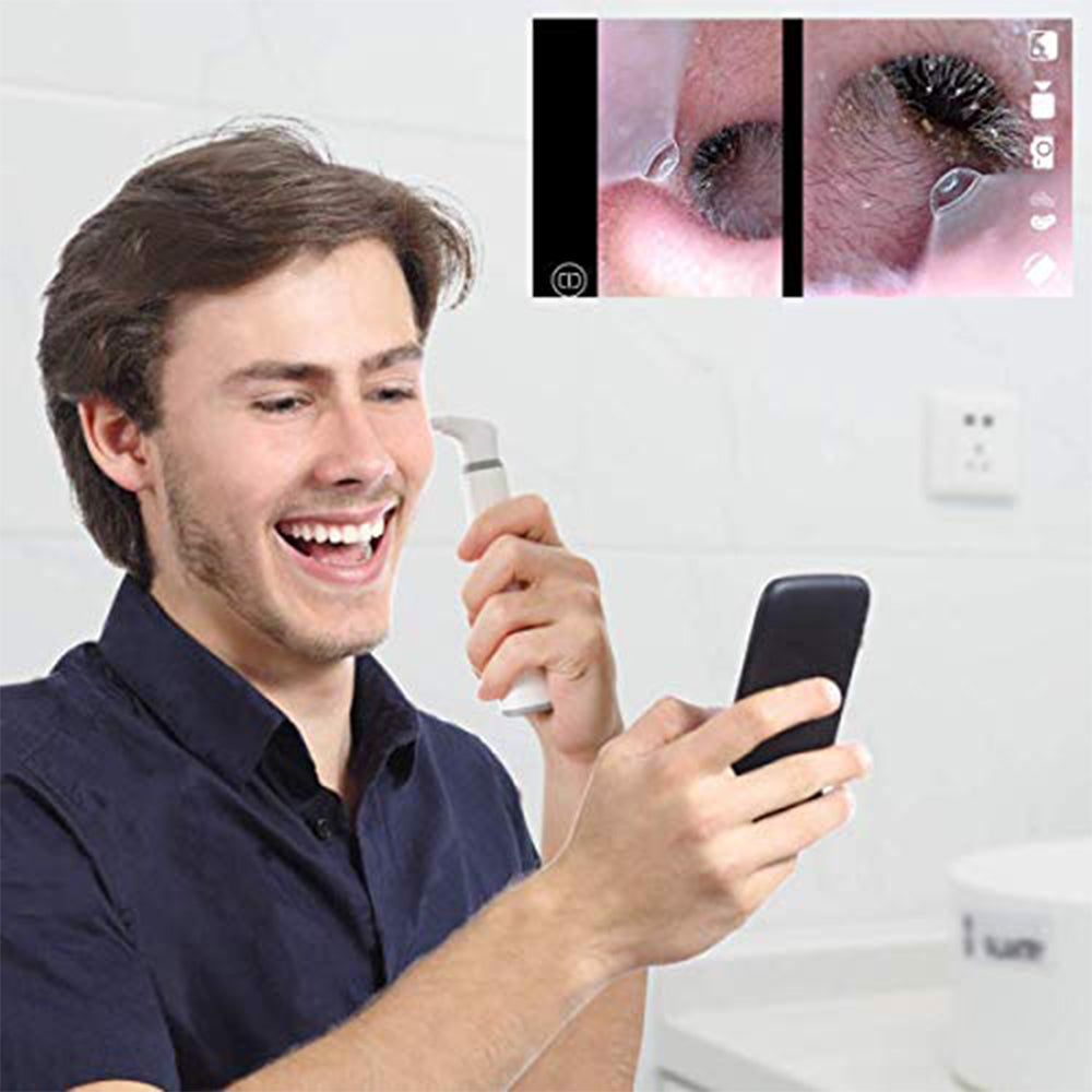 3.9mm WiFi Ear Scope Camera with Earwax Removal Tool 6 LED Lights Ear Endoscope Otoscope