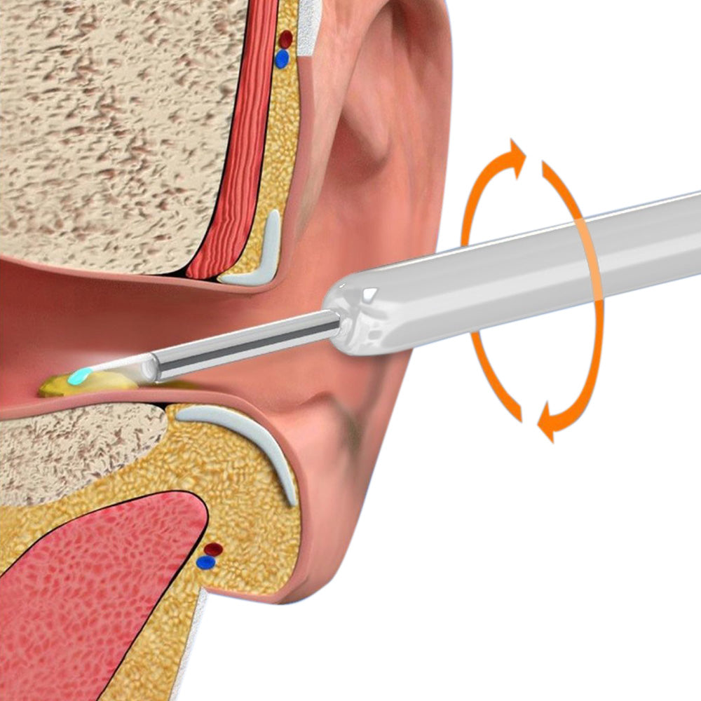 Wireless WiFi Ear Wax Removal Kit with HD Camera 360 Degree Visual Ear Cleaner